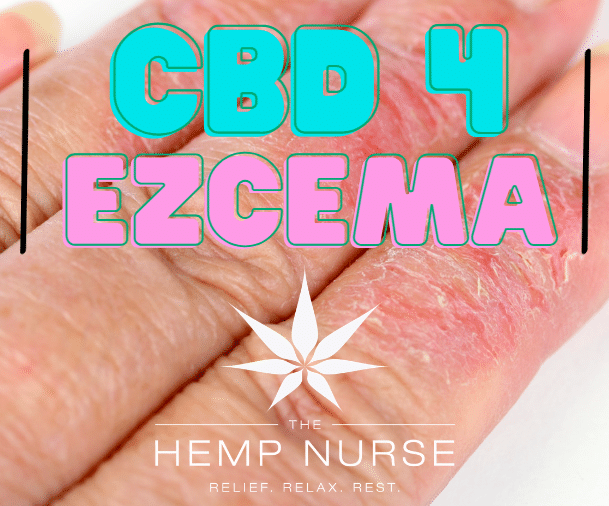 Eczema Relief with CBD Oil